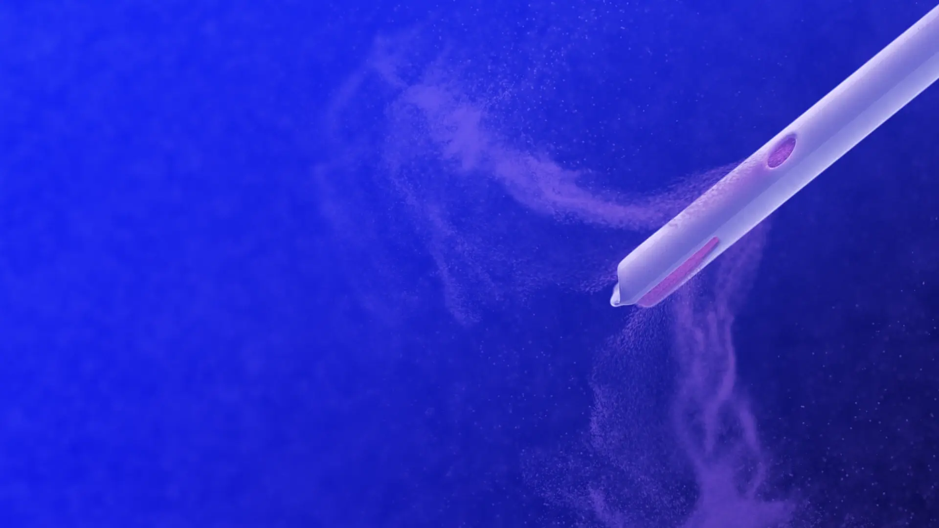 Cerulean’s original visualisation of a ventricular catheter